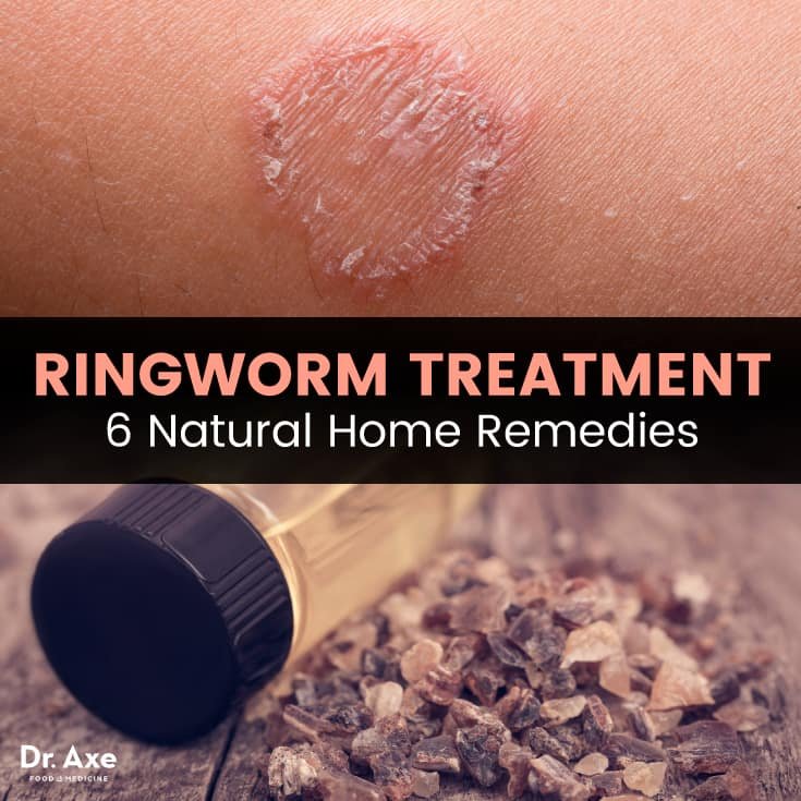 Ringworm_ArticleMeme